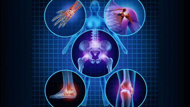 Arthritis Treatment in India