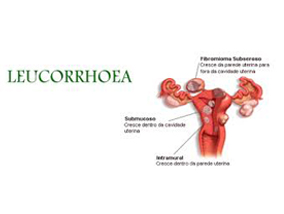 Ayurvedic Treatment for Leucorrhoea
