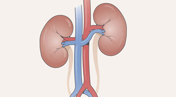 Kidney Disease Ayurvedic Treatment in India