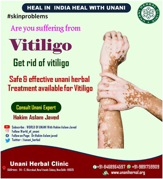 Most Effective Vitiligo Ayurvedic Remedy